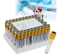 Provette for il prelievo del sangue for la separazione siero e | La preparazione del PRP Nelle impostazioni di laboratorio(5ML)