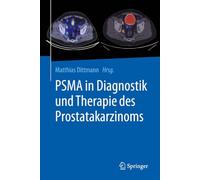 PSMA in Diagnostik und Therapie des Prostatakarzinoms