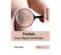 Psoriasis: Causes, Diagnosis and Therapies (Copertina rigida)