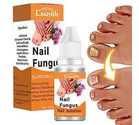 Qiongni - Soluzione naturale per unghie dei piedi, cura extra forte, 10 ml, soluzione per la cura delle unghie, riparazione per unghie danneggiate, liquido rigenerante unghie scolorite