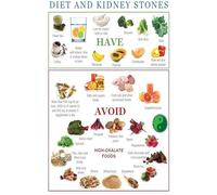 QMIQXIWS Kidney Stone Prevention Food List - Educational Nutrition Chart for Healthy Eating, Hydration and Low Oxalate Guide, Kitchen Wall Decor for Home and Office(Unframed,08x12inch(20x30cm))