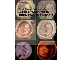 Rabih Chaoui Kai-Sven Heli 3D Ultrasound in Prenatal Diagnos (Copertina rigida)