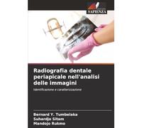 Radiografia dentale periapicale nell'analisi delle immagini: Identificazione e caratterizzazione