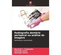 Radiografia dentária periapical na análise de imagens: Identificação e caracterização