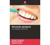 Recessão gengival: e as modalidades de tratamento.