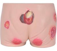 Regalo medico, modello infermieristico avanzato for piaghe da decubito, modello infermieristico, modello for la cura dell'ulcera da decubito dei glutei con ferite multiple simulate