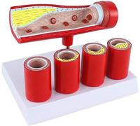 Regalo medico, modello simile all'arteria coronarica dell'arteria cardiovascolare, modello di trombosi di formazione di sclerosi dell'arteria anatomica umana del ramo invecchiato, modello anatomico