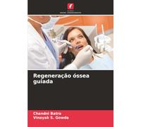 Regeneração óssea guiada