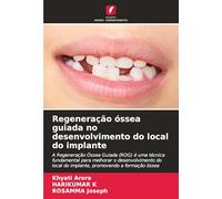 Regeneração óssea guiada no desenvolvimento do local do implante: A Regeneração Óssea Guiada (ROG) é uma técnica fundamental para melhorar o ... do implante, promovendo a formação óssea