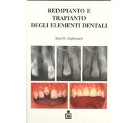 Reimpianto. Il reinserimento dei denti