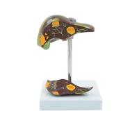 Removable Liver Anatomy Model Simulated Pathological Organ with Detachable Sections for Medical Education Umana Modello