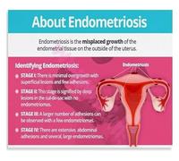 Reproductive Health Information Chart Canvas Wall Art Poster for Health Education Classroom Decor(Framed,12x18inch(30x45cm))