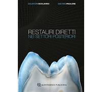 Restauri Diretti nei Settori Posteriori