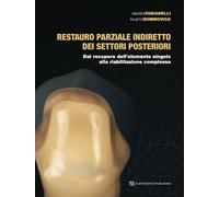 Restauro parziale indiretto dei settori posteriori. Dal recupero dell'elemento singolo alla riabilitazione complessa
