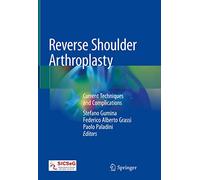 Reverse Shoulder Arthroplasty: Current Techniques and Complications
