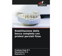 Riabilitazione della bocca completa con protesi parziali fisse