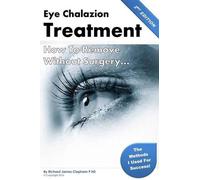 Richard James Clapham Phd Eye Chalazion (Tascabile)