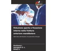 Riduzione aperta e fissazione interna nella frattura anteriore mandibolare: Dalla frattura alla fissazione: Una panoramica chirurgica