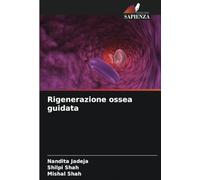 Rigenerazione ossea guidata