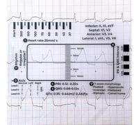Righello ECG a 7 gradini,Strumento di misurazione del righello di plastica del righello ECG,Righello a 7 gradini ECG per l'interpretazione ECG/ECG,Strumento di misurazione trasparente per pinze
