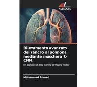 Rilevamento avanzato del cancro al polmone mediante maschera R-CNN.: Un approccio di deep learning all'imaging medico