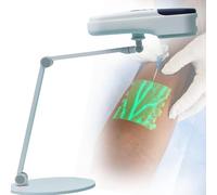 Rilevatore Della Vena + Supporto Da Tavolo, 7 Colori/5 Livelli Di Luminosità, Distanza Di Imaging Migliore: 15-25 Cm, Visualizzazione Dell'Illuminazione Per Medici, Infermieri, Anziani E Bambini