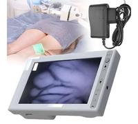 Rilevatore di Vene Portatile a Infrarossi, Display Led da 5,5 Pollici + Peso Ultraleggero di 240 G + con Supporto, Rilevamento Efficiente Delle Vene per Vari Tipi di Pelle, per Uso Medico e Clinico