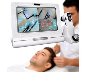 Rilevatore professionale di cuoio capelluto Analizzatore di capelli con ingrandimento 50X/200X con sonde a doppia impugnatura per la diagnosi in salone