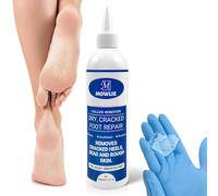Rimozione calli per piedi - formulazione originale e potente - gel extra forte, risultati spa pedicure casa - Forniture per pelle secca screpolata e morta -3
