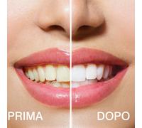 RIO Sistema sbiancante per i denti Smile Advanced Blue-Light