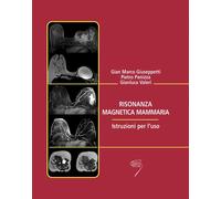 Risonanza magnetica mammaria. Istruzioni per l'uso - 2009 - Polet