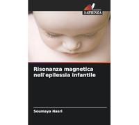 Risonanza magnetica nell'epilessia infantile