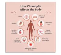 RNUMLIGH Office Poster Chlamydia Infection Warning Signs List | Help patients recognize when to seek professional healthcare advice promptly.(Framed,16x24inch(40x60cm))