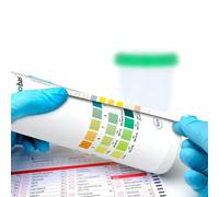 Roche Combur 3 Test® strisce reattive per urine 50 pz Strisce reattive