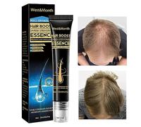 Roll-On per la crescita dei capelli alla biotina | Rullo per la ricrescita dei capelli 20ml - Massaggiatore per il cuoio capelluto per la crescita dei capelli con olio di biotina per la Chaies