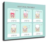 Root Canal Treatment Educational Poster Oral Health Reference for Dentist Office Home Study(Framed,16x24inch(40x60cm))