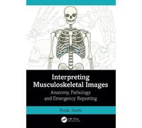 Rosie Jones Interpreting Musculoskeletal Images (Tascabile)