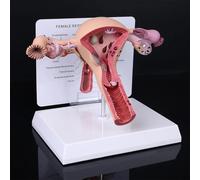 Ryanong Modello dell'ovaio utero patologico dell'organo riproduttivo femminile anatomico umano con scheda di visualizzazione educativa e base per l'insegnamento scolastico