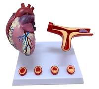 Ryanong Modello di cuore umano, modello di bypass dell'arteria coronarica del cuore, modello di trombosi di blocco dei vasi sanguigni Modello di insegnamento della scienza per il modello di anatomia