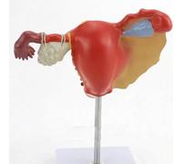 Ryanong Modello di ovaia femminile, modello di anatomia patologica uterina, modello di organo rimovibile della cervice cervicale ovaia di Falloppio per esposizione didattica.