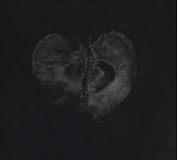 Sadon & Treha Sektori - Symphony of dying