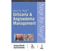 Sanjay Ghosh Saurav Ku Step by Step: Urticaria & Angioedema Managem (Tascabile)