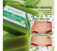 Saponetta schiarente all'aloe, rimuove macchie scure, macchie solari, acne, controllo dell'olio, macchie pulite, esfoliazione, per viso e corpo, 200 g