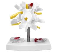 Sarini Disco Lombare anatomico, Modello scientifico della Colonna vertebrale, Anatomia, ernia del Disco, Modello dimostrativo, Colonna vertebrale Umana, Modello del Disco