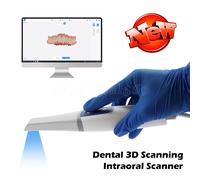 Scanner Intraorale Dentale per Odontoiatria Restaurativa CAD/CAM