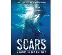 Scars