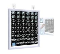 Scatola Luminosa For Visore For Pellicole Radiografiche Da 1,8 Cm | Luminosità regolabile con supporto da parete e supporto da tavolo, negatoscopio medico for odontoiatria(30X20in/77X51cm)