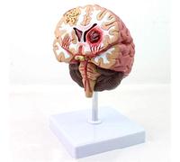 Scheletro Brain Umano Modello anaico anaico Modello di malattia cerebrale Umana Patologie cerebrali Emorragia cerebrale del Tronco cerebrale per Lo Studio Mostra l'insegnamento e Il Modello A