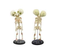 Scheletro umano Feto infantile Modello 15" Mini strumento di studio anatomico montato su asta teschio gemello siamese, 1 pz