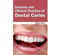 Science and Clinical Practice of Dental Caries (Copertina rigida)